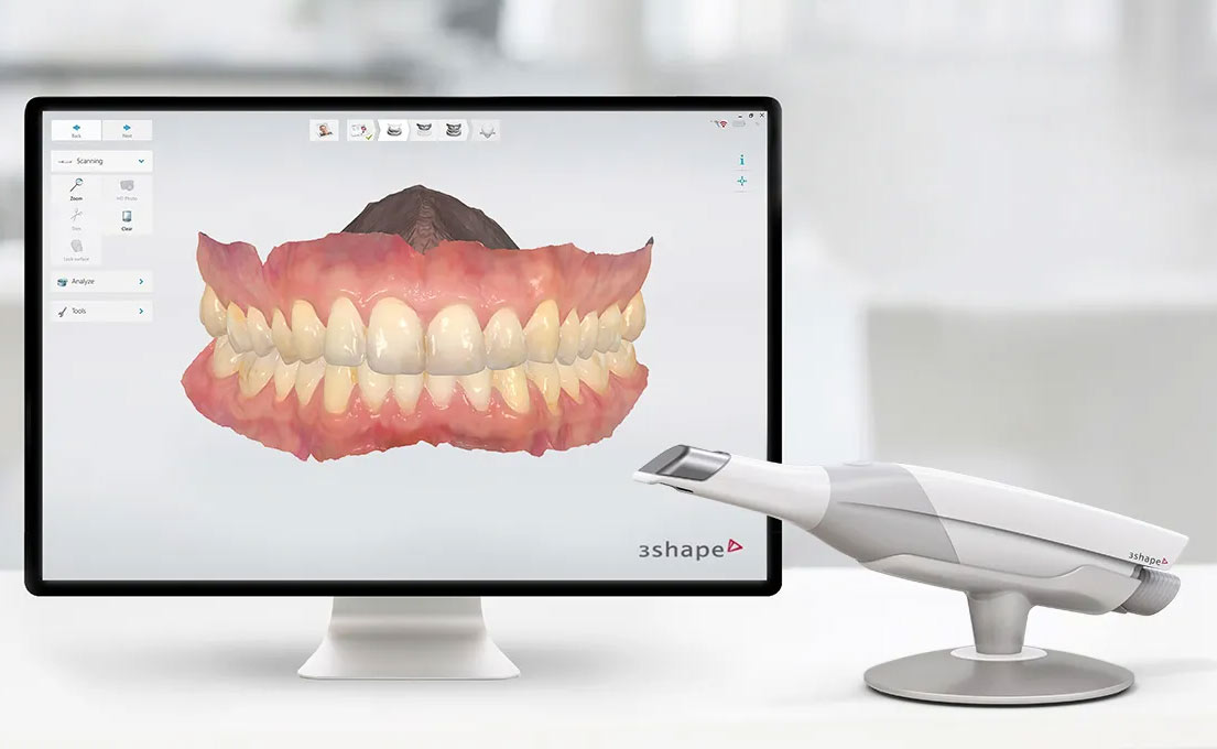 le scanner intra oral 3D